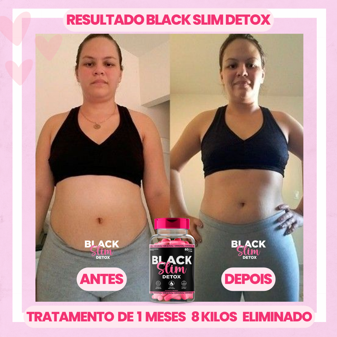 antes e depois (1)