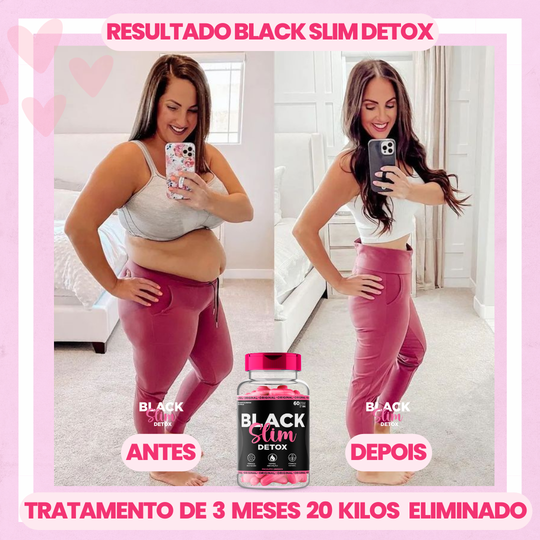 antes e depois (2)